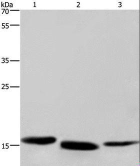 CYB5A / Cytochrome b5 Antibody - Western blot analysis of Human kidney cancer, mouse liver and human bladder carcinoma tissue, using CYB5A Polyclonal Antibody at dilution of 1:300.