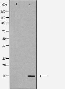 CYB5A / Cytochrome b5 Antibody - Western blot analysis of CYB5 expression in A549 cells. The lane on the left is treated with the antigen-specific peptide.