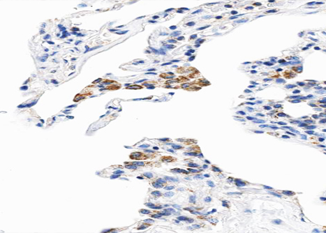 CYB5A / Cytochrome b5 Antibody - 1:100 staining human lung tissue by IHC-P. The tissue was formaldehyde fixed and a heat mediated antigen retrieval step in citrate buffer was performed. The tissue was then blocked and incubated with the antibody for 1.5 hours at 22°C. An HRP conjugated goat anti-rabbit antibody was used as the secondary.