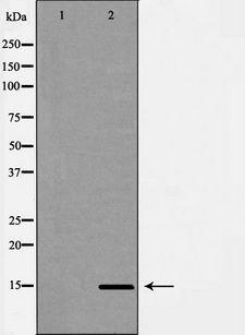 CYB5A / Cytochrome b5 Antibody - Western blot analysis of A549 whole cells lysates using CYB5A antibody. The lane on the left is treated with the antigen-specific peptide.