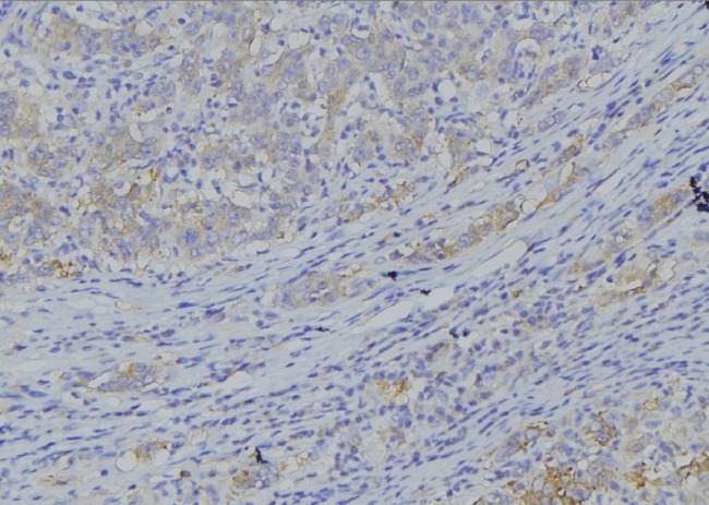 CYB5A / Cytochrome b5 Antibody - 1:100 staining human gastric tissue by IHC-P. The sample was formaldehyde fixed and a heat mediated antigen retrieval step in citrate buffer was performed. The sample was then blocked and incubated with the antibody for 1.5 hours at 22°C. An HRP conjugated goat anti-rabbit antibody was used as the secondary.