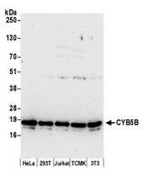 CYB5B Antibody - Detection of human and mouse CYB5B by western blot. Samples: Whole cell lysate (15 µg) from HeLa, HEK293T, Jurkat, mouse TCMK-1, and mouse NIH 3T3 cells prepared using NETN lysis buffer. Antibody: Affinity purified rabbit anti-CYB5B antibody used for WB at 0.1 µg/ml. Detection: Chemiluminescence with an exposure time of 30 seconds.
