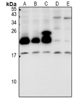 CYB5B Antibody - Western blot analysis of Cytochrome b5B expression in HCT116 (A), LO2 (B), HepG2 (C), AML12 (D), PC12 (E) whole cell lysates.