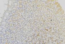 CYB5B Antibody - 1:100 staining human gastric tissue by IHC-P. The sample was formaldehyde fixed and a heat mediated antigen retrieval step in citrate buffer was performed. The sample was then blocked and incubated with the antibody for 1.5 hours at 22°C. An HRP conjugated goat anti-rabbit antibody was used as the secondary.