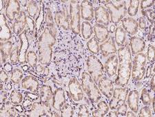 CYB5B Antibody - Immunochemical staining of human CYB5B in human kidney with rabbit polyclonal antibody at 1:100 dilution, formalin-fixed paraffin embedded sections.