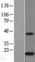 CYB5B Protein - Western validation with an anti-DDK antibody * L: Control HEK293 lysate R: Over-expression lysate