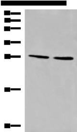 CYB5D1 Antibody - Western blot analysis of LOVO and 231 cell lysates  using CYB5D1 Polyclonal Antibody at dilution of 1:650