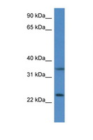 CYB5R1 Antibody - CYB5R1 antibody Western blot of Mouse Thymus lysate. Antibody concentration 1 ug/ml.  This image was taken for the unconjugated form of this product. Other forms have not been tested.