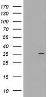 CYB5R1 Antibody - HEK293T cells were transfected with the pCMV6-ENTRY control (Left lane) or pCMV6-ENTRY CYB5R1 (Right lane) cDNA for 48 hrs and lysed. Equivalent amounts of cell lysates (5 ug per lane) were separated by SDS-PAGE and immunoblotted with anti-CYB5R1.