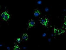 CYB5R1 Antibody - Anti-CYB5R1 mouse monoclonal antibody immunofluorescent staining of COS7 cells transiently transfected by pCMV6-ENTRY CYB5R1.