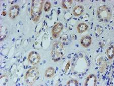 CYB5R1 Antibody - IHC of paraffin-embedded Human Kidney tissue using anti-CYB5R1 mouse monoclonal antibody. (Heat-induced epitope retrieval by 10mM citric buffer, pH6.0, 100C for 10min).