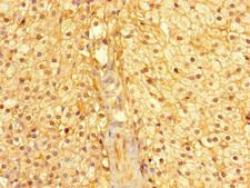 CYB5R1 Antibody - Immunohistochemistry of paraffin-embedded human adrenal gland tissue using CYB5R1 Antibody at dilution of 1:100