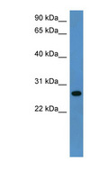 CYB5R2 Antibody - CYB5R2 antibody Western blot of Rat Lung lysate. This image was taken for the unconjugated form of this product. Other forms have not been tested.