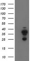 CYB5R2 Antibody - HEK293T cells were transfected with the pCMV6-ENTRY control (Left lane) or pCMV6-ENTRY CYB5R2 (Right lane) cDNA for 48 hrs and lysed. Equivalent amounts of cell lysates (5 ug per lane) were separated by SDS-PAGE and immunoblotted with anti-CYB5R2.