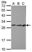 CYB5R2 Antibody - Sample (30 ug of whole cell lysate) A: PC-3 B: U87-MG C: SK-N-SH 12% SDS PAGE CYB5R2 antibody diluted at 1:1000