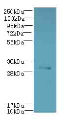 CYB5R2 Antibody - Western blot. All lanes: CYB5R2 antibody at 4 ug/ml+Mos- kidney tissue Goat polyclonal to rabbit at 1:10000 dilution. Predicted band size: 31 kDa. Observed band size: 31 kDa.