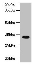 CYB5R2 Antibody - Western blot All lanes: CYB5R2 antibody at 4µg/ml + Mouse kidney tissue Secondary Goat polyclonal to rabbit IgG at 1/10000 dilution Predicted band size: 32, 28 kDa Observed band size: 32 kDa