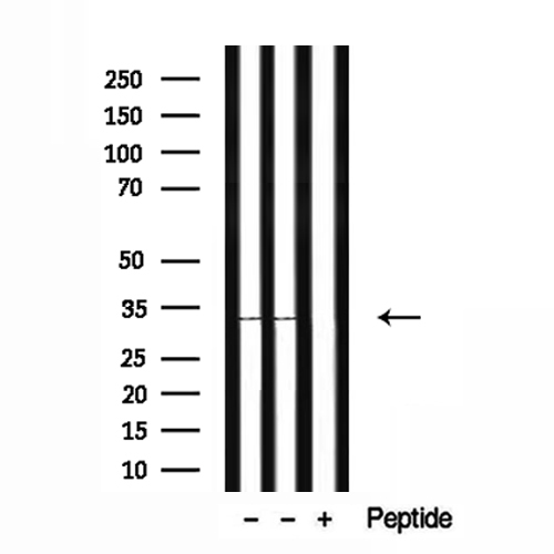 CYB5R2 Antibody - Western blot analysis of extracts of HepG2 and mouse heart tissue using CYB5R2 antibody.