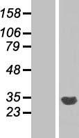 CYB5R2 Protein - Western validation with an anti-DDK antibody * L: Control HEK293 lysate R: Over-expression lysate
