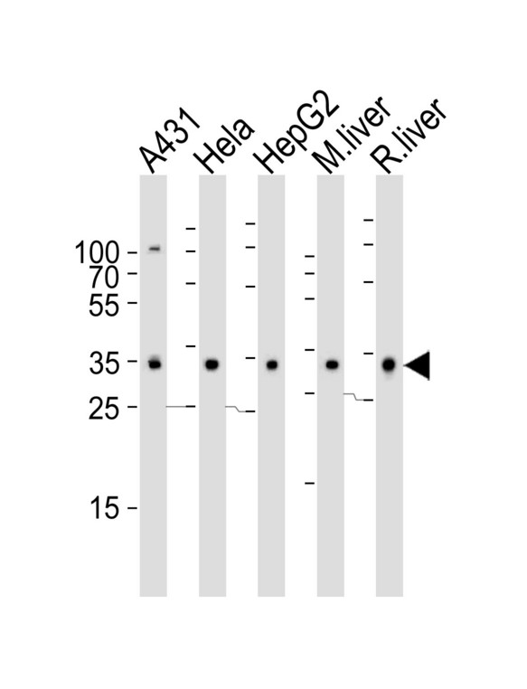 CYB5R3 / B5R Antibody - Western blot of lysates from A431, HeLa, HepG2 cell line , mouse liver and rat liver tissue lysate (from left to right) with CYB5R3 Antibody. Antibody was diluted at 1:1000 at each lane. A goat anti-rabbit IgG H&L (HRP) at 1:5000 dilution was used as the secondary antibody. Lysates at 35 ug per lane.