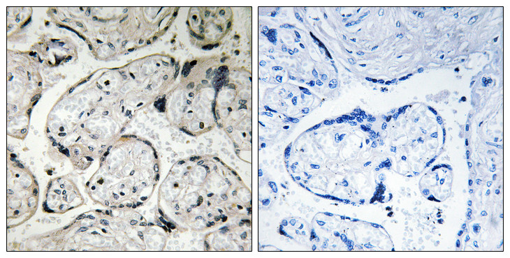 CYB5R3 / B5R Antibody - Immunohistochemistry analysis of paraffin-embedded human placenta tissue, using CYB5R3 Antibody. The picture on the right is blocked with the synthesized peptide.