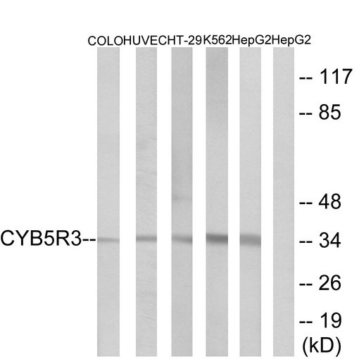 CYB5R3 / B5R Antibody - Western blot analysis of lysates from HepG2, COLO, HUVEC, HT-29, and K562 cells, using CYB5R3 Antibody. The lane on the right is blocked with the synthesized peptide.