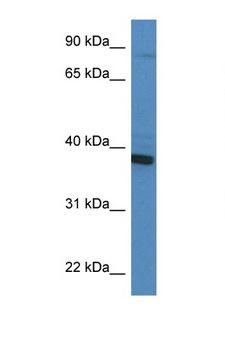 CYB5R3 / B5R Antibody - CYB5R3 antibody Western blot of HT1080 Cell lysate. Antibody concentration 1 ug/ml.  This image was taken for the unconjugated form of this product. Other forms have not been tested.