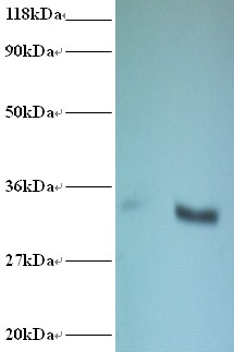 CYB5R3 / B5R Antibody - Western blot of NADH-cytochrome b5 reductase 3 antibody at 2 ug/ml. Lane 1: EC109 whole cell lysate. Lane 2: 293T whole cell lysate. Secondary: Goat polyclonal to Rabbit IgG at 1:15000 dilution. Predicted band size: 33 kDa. Observed band size: 33 kDa.  This image was taken for the unconjugated form of this product. Other forms have not been tested.