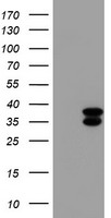 CYB5R3 / B5R Antibody - HEK293T cells were transfected with the pCMV6-ENTRY control (Left lane) or pCMV6-ENTRY CYB5R3 (Right lane) cDNA for 48 hrs and lysed. Equivalent amounts of cell lysates (5 ug per lane) were separated by SDS-PAGE and immunoblotted with anti-CYB5R3.