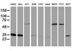 CYB5R3 / B5R Antibody - Western blot of extracts (35ug) from 9 different cell lines by using anti-CYB5R3 monoclonal antibody.