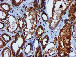 CYB5R3 / B5R Antibody - IHC of paraffin-embedded Human Kidney tissue using anti-CYB5R3 mouse monoclonal antibody. (Heat-induced epitope retrieval by 10mM citric buffer, pH6.0, 100C for 10min).