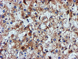 CYB5R3 / B5R Antibody - IHC of paraffin-embedded Human liver tissue using anti-CYB5R3 mouse monoclonal antibody. (Heat-induced epitope retrieval by 10mM citric buffer, pH6.0, 100C for 10min).