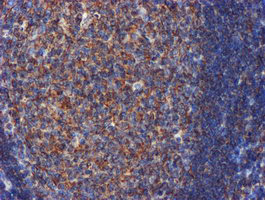 CYB5R3 / B5R Antibody - IHC of paraffin-embedded Human tonsil using anti-CYB5R3 mouse monoclonal antibody. (Heat-induced epitope retrieval by 10mM citric buffer, pH6.0, 100C for 10min).