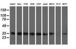 CYB5R3 / B5R Antibody - Western blot analysis of extracts (35ug) from 9 different cell lines by using anti-CYB5R3 monoclonal antibody.