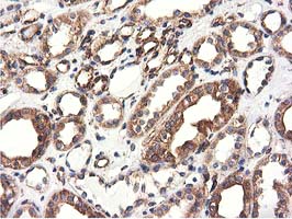 CYB5R3 / B5R Antibody - Immunohistochemical staining of paraffin-embedded Human Kidney tissue using anti-CYB5R3 mouse monoclonal antibody.