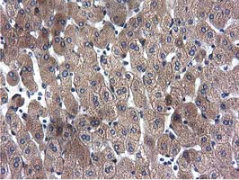 CYB5R3 / B5R Antibody - Immunohistochemical staining of paraffin-embedded Human liver tissue using anti-CYB5R3 mouse monoclonal antibody.