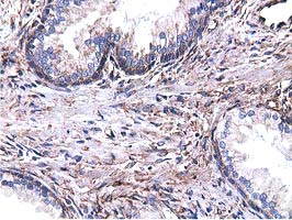 CYB5R3 / B5R Antibody - Immunohistochemical staining of paraffin-embedded Human prostate tissue using anti-CYB5R3 mouse monoclonal antibody.