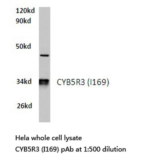 CYB5R3 / B5R Antibody - Western blot of CYB5R3 (I169) pAb in extracts from HeLa cells.