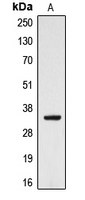CYB5R3 / B5R Antibody - Western blot analysis of CYB5R3 expression in HeLa (A) whole cell lysates.