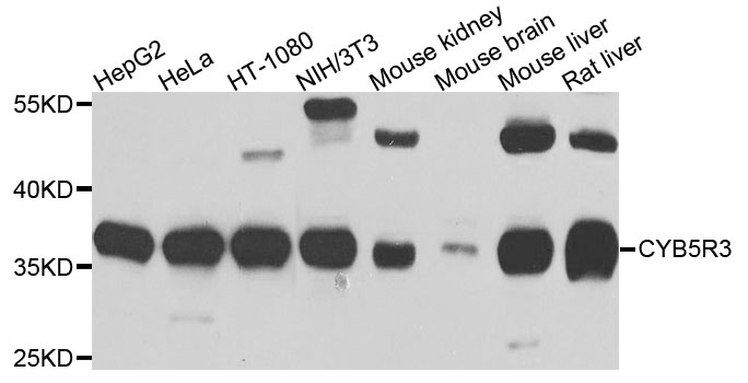 CYB5R3 / B5R Antibody - Western blot analysis of extracts of various cells.