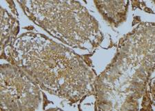 CYB5R3 / B5R Antibody - 1:100 staining mouse testis tissue by IHC-P. The sample was formaldehyde fixed and a heat mediated antigen retrieval step in citrate buffer was performed. The sample was then blocked and incubated with the antibody for 1.5 hours at 22°C. An HRP conjugated goat anti-rabbit antibody was used as the secondary.