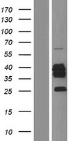 CYB5R3 / B5R Protein - Western validation with an anti-DDK antibody * L: Control HEK293 lysate R: Over-expression lysate