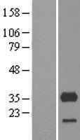 CYB5R3 / B5R Protein - Western validation with an anti-DDK antibody * L: Control HEK293 lysate R: Over-expression lysate