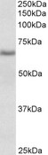 CYB5R4 Antibody - CYB5R4 antibody (0.1 ug/ml) staining of Rat Spleen lysate (35 ug protein in RIPA buffer). Primary incubation was 1 hour. Detected by chemiluminescence.