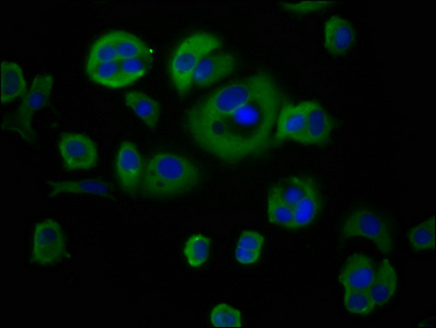 CYBA / p22phox Antibody - Immunofluorescence staining of MCF-7 cells at a dilution of 1:66, counter-stained with DAPI. The cells were fixed in 4% formaldehyde, permeabilized using 0.2% Triton X-100 and blocked in 10% normal Goat Serum. The cells were then incubated with the antibody overnight at 4 °C.The secondary antibody was Alexa Fluor 488-congugated AffiniPure Goat Anti-Rabbit IgG (H+L) .