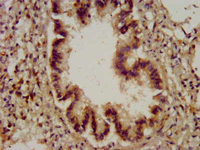 CYBA / p22phox Antibody - IHC image of CYBA Antibody diluted at 1:200 and staining in paraffin-embedded human lung tissue performed on a Leica BondTM system. After dewaxing and hydration, antigen retrieval was mediated by high pressure in a citrate buffer (pH 6.0). Section was blocked with 10% normal goat serum 30min at RT. Then primary antibody (1% BSA) was incubated at 4°C overnight. The primary is detected by a biotinylated secondary antibody and visualized using an HRP conjugated SP system.