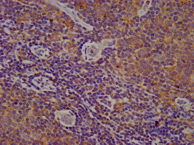 CYBA / p22phox Antibody - IHC image of CYBA Antibody diluted at 1:200 and staining in paraffin-embedded human lymph node tissue performed on a Leica BondTM system. After dewaxing and hydration, antigen retrieval was mediated by high pressure in a citrate buffer (pH 6.0). Section was blocked with 10% normal goat serum 30min at RT. Then primary antibody (1% BSA) was incubated at 4°C overnight. The primary is detected by a biotinylated secondary antibody and visualized using an HRP conjugated SP system.