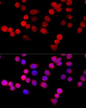CYBA / p22phox Antibody - Immunofluorescence analysis of HeLa cells using CYBA Polyclonal Antibody at dilution of 1:100 (40x lens).Blue: DAPI for nuclear staining.