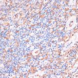 CYBA / p22phox Antibody - Immunohistochemistry of paraffin-embedded Human tonsil using CYBA Polyclonal Antibody at dilution of 1:100 (40x lens).