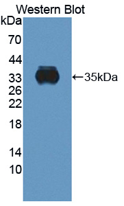 CYBB / NOX2 / gp91phox Antibody - Western blot of CYBB / NOX2 / gp91phox antibody.